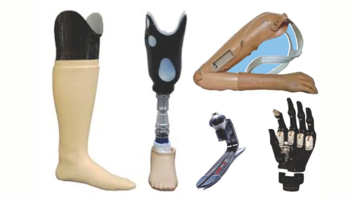 Patient fitted with an artificial limb at a Pakistani rehabilitation center in 2025