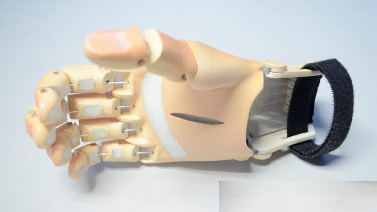 Artificial hand being used by a person in Pakistan