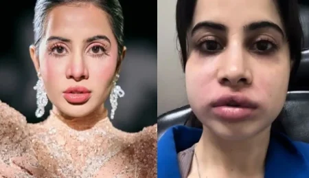 In the dazzling world of social media glam, nothing spells drama quite like a botched beauty work such as the one Uorfi Javed served us!