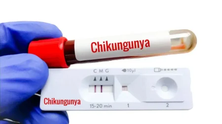 chikungunya virus china